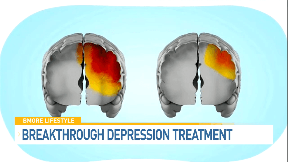 Breakthrough depression treatment offers fast relief